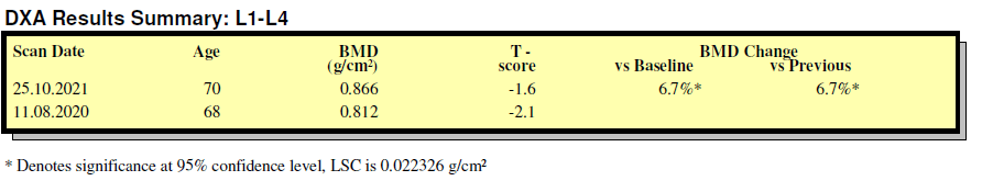 Densytometria DXA results Densytometria